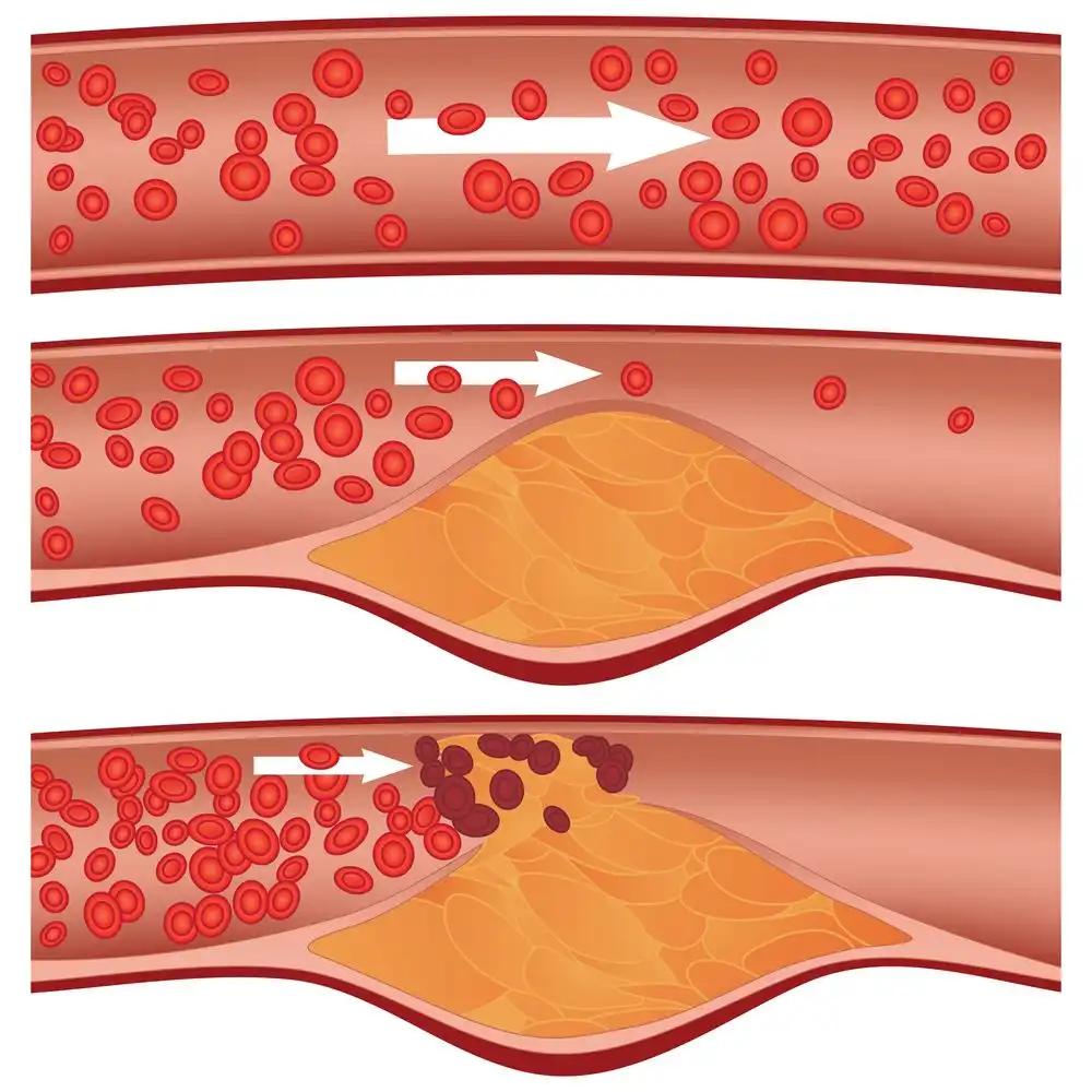 Cholesterol Levels 1