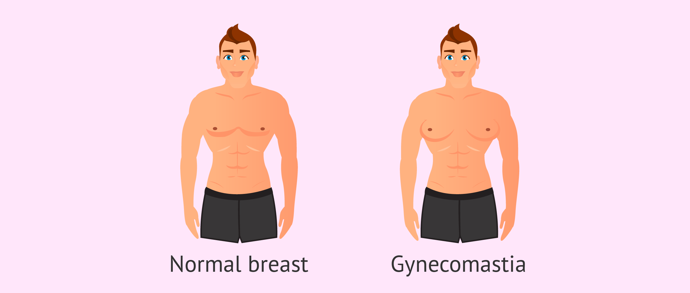 Gynecomastia Vs Normal Breast 1