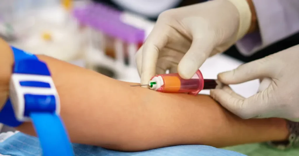 Showcase Of Blood Testing